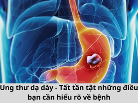 Ung thư dạ dày - Tất tần tật những điều bạn cần hiểu rõ về bệnh